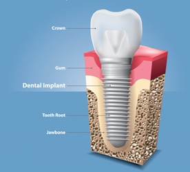 Best dental clinic in somajiguda