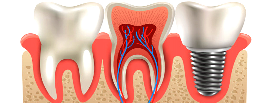 Best family dental clinic